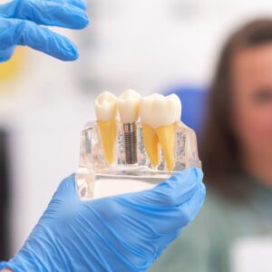 Implant Surgery to Final Restoration